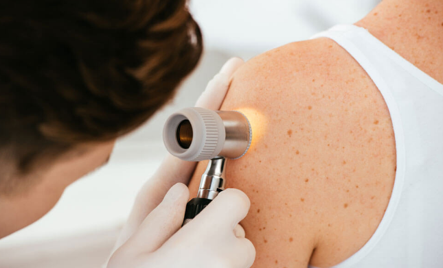 understanding dermatology using a quiz